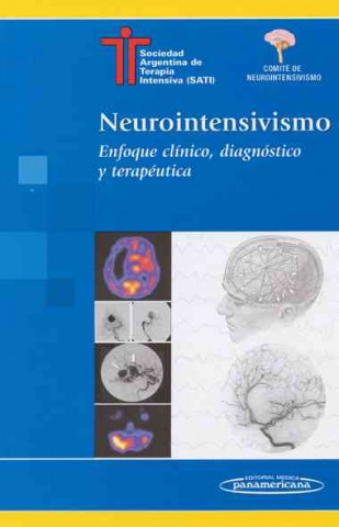 Neurointensivismo. Enfoque clínico, diagnóstico y terapéutica.