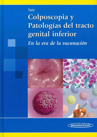 Colposcopia y Patologías del Tracto Genital Inferior