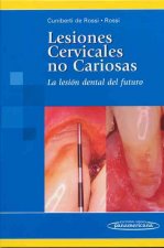 Lesiones Cervicales no Cariosas. La Lesión dental del futuro