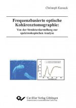 Frequenzbasierte optische Kohärenztomographie: Von der Strukturdarstellung zur spektroskopischen Analyse