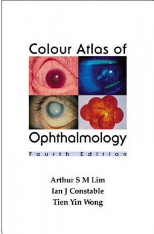 Colour Atlas of Ophthalmology (4th Edition)