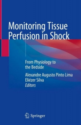Monitoring Tissue Perfusion in Shock