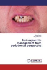 Peri-implantitis management from periodontal perspective