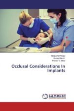 Occlusal Considerations In Implants
