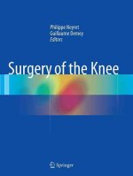 Surgery of the Knee