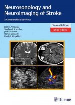 Neurosonology and Neuroimaging of Stroke