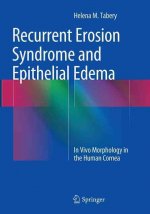 Recurrent Erosion Syndrome and Epithelial Edema
