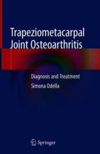 Trapeziometacarpal Joint Osteoarthritis