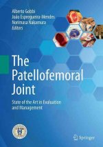 Patellofemoral Joint