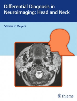 Differential Diagnosis in Neuroimaging: Head and Neck (P. Steven Meyers)(Twarda)
