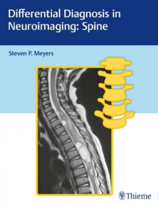 Differential Diagnosis in Neuroimaging: Spine (P. Steven Meyers)(Twarda)
