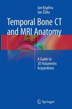 Temporal Bone CT and MRI Anatomy