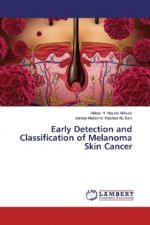 Early Detection and Classification of Melanoma Skin Cancer