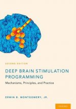 Deep Brain Stimulation Programming