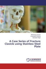 A Case Series of Fracture Clavicle using Stainless Steel Plate