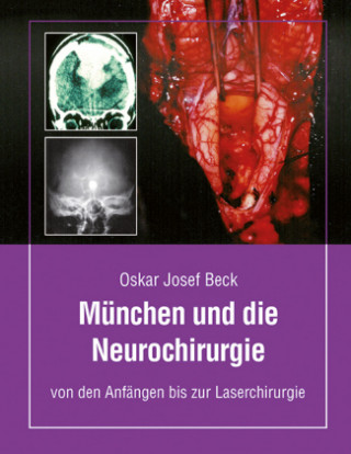 München und die Neurochirurige