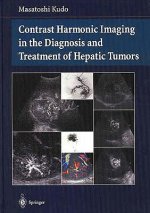 Contrast Harmonic Imaging in the Diagnosis and Treatment of Hepatic Tumors