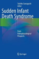 Sudden Infant Death Syndrome