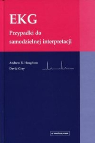 EKG Przypadki do samodzielnej interpretacji