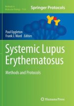 Systemic Lupus Erythematosus