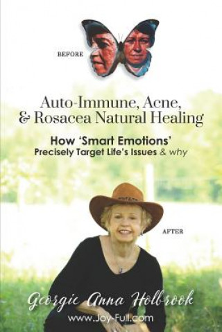 Auto-Immune, Acne, & Rosacea Natural Healing - How 'Smart Emotions' Precisely Target Life's Issues & Why