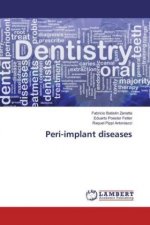 Peri-implant diseases