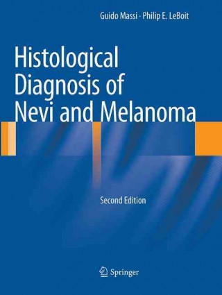 Histological Diagnosis of Nevi and Melanoma