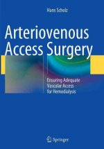 Arteriovenous Access Surgery