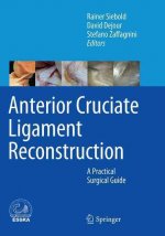 Anterior Cruciate Ligament Reconstruction