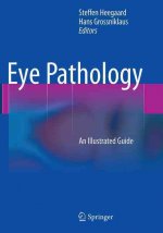 Eye Pathology