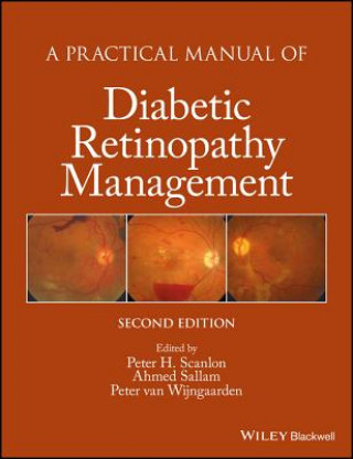 Practical Manual of Diabetic Retinopathy Management 2e