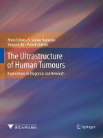 Ultrastructure of Human Tumours