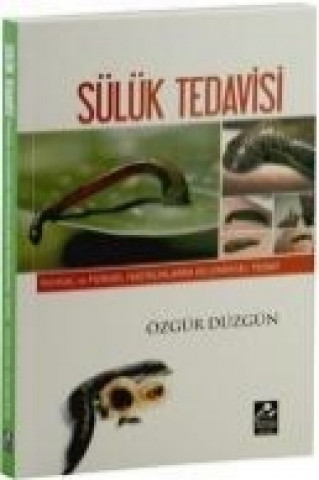 Sülük Tedavisi