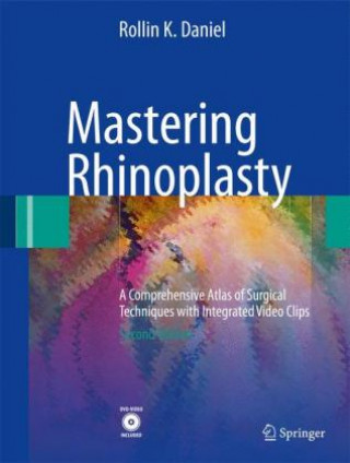 Mastering Rhinoplasty
