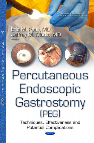 Percutanous Endoscopic Gastrostomy (PEG)