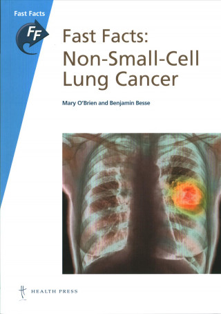 Fast Facts: Non-Small-Cell Lung Cancer