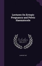 Lectures on Ectopic Pregnancy and Pelvic Haematocele