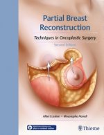 Partial Breast Reconstruction