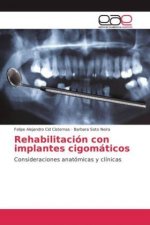 Rehabilitación con implantes cigomáticos