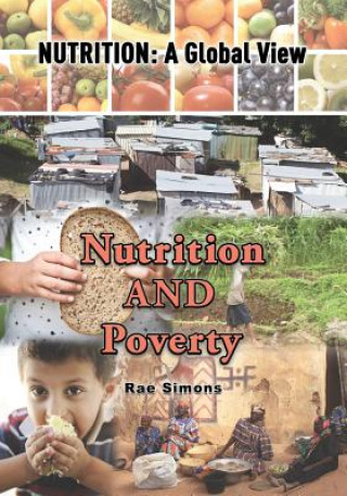 NUTRITION & POVERTY