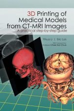 3D Printing of Medical Models from CT-MRI Images