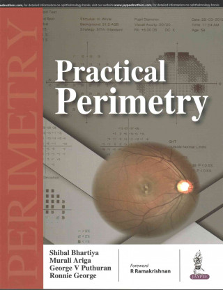Practical Perimetry