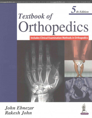 Textbook of Orthopedics