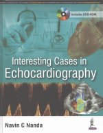 Interesting Cases in Echocardiography