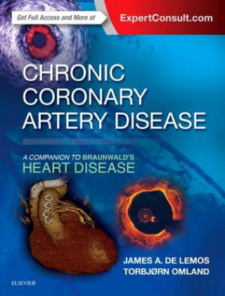 Chronic Coronary Artery Disease (James Delemos)(Twarda)