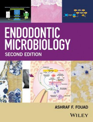 Endodontic Microbiology 2e
