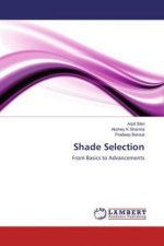 Shade Selection