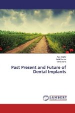 Past Present and Future of Dental Implants