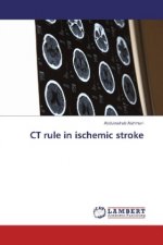 CT rule in ischemic stroke