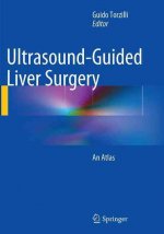 Ultrasound-Guided Liver Surgery